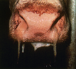 BHV1-Infektion (IBR)